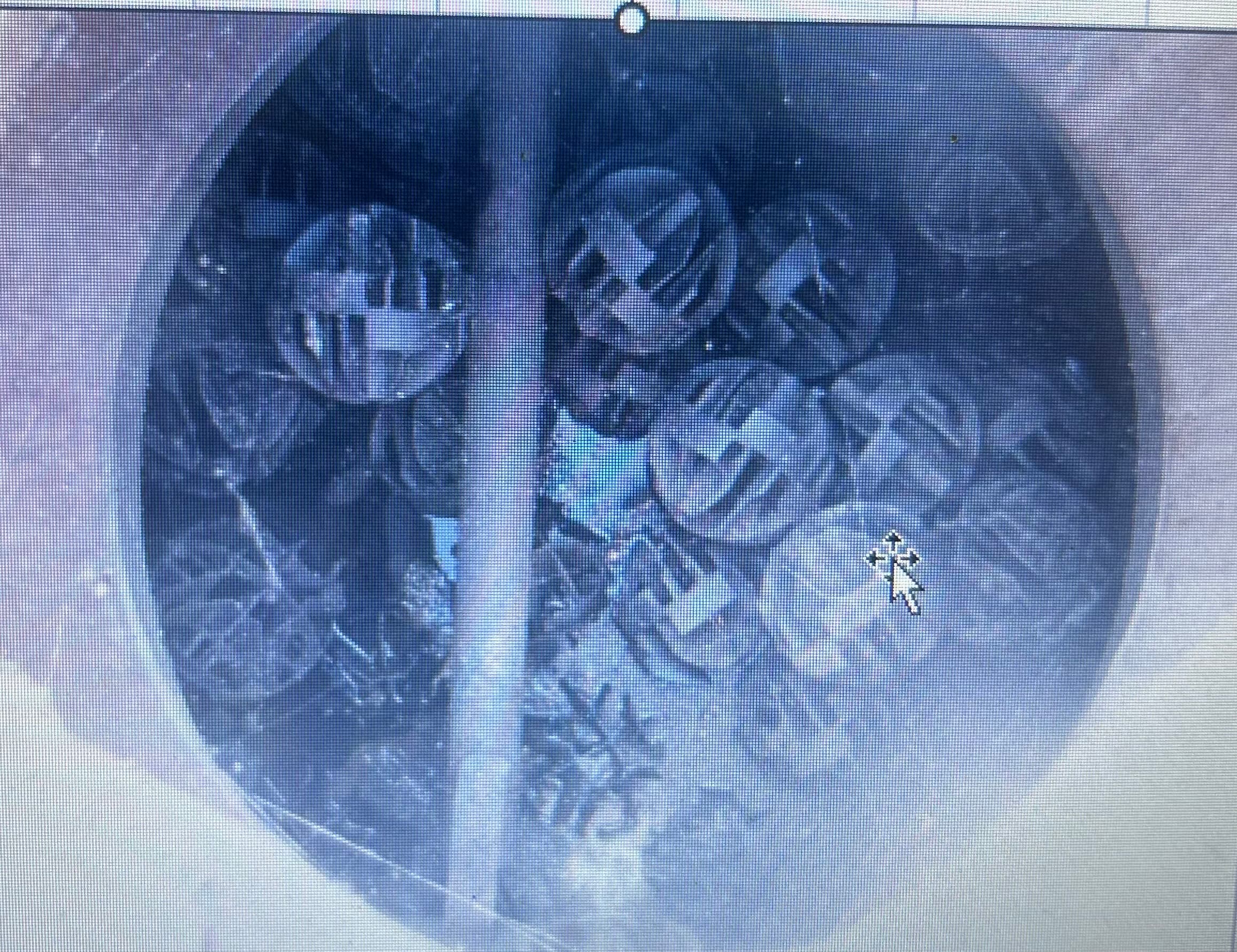 水廻りリフォーム工事前 - 浄化槽関連設備の改修が必要な状態